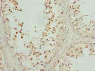 Polyclonal Rabbit anti-Human LYAR Antibody (IHC, WB)