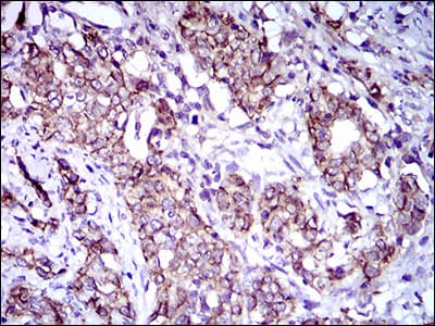 Monoclonal Mouse anti-Human ALCAM / CD166 Antibody (clone 8E12C7, aa48-216, IHC, IF, WB)