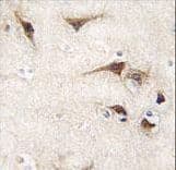 Polyclonal Rabbit anti-Human TYRO3 Antibody (IHC, WB)