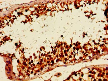 Polyclonal Rabbit anti-Human SMARCA3 / HLTF Antibody (IHC, WB)