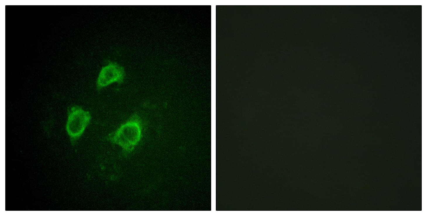 KCNB1 / Kv2.1 Antibody (phospho-Ser567)