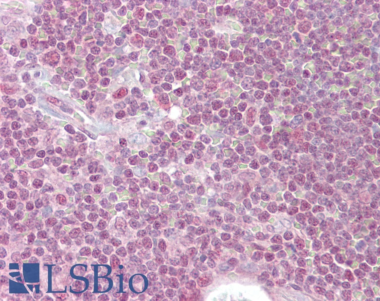 IHC-plus™ Polyclonal Goat anti-Human PPP1R8 / Rnase E Antibody (aa338-351, IHC, WB)