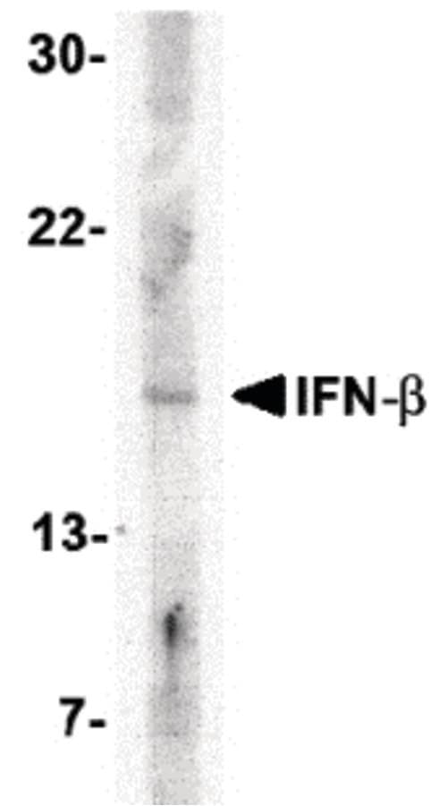 Polyclonal Rabbit anti-Human IFN Beta / Interferon Beta Antibody (IHC, IF, WB)
