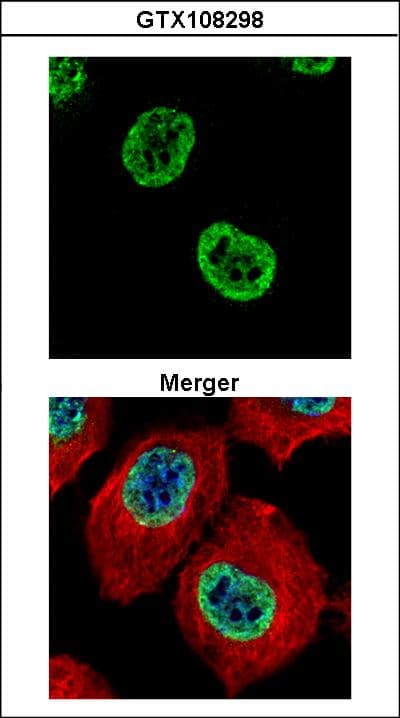Polyclonal Rabbit anti-Human H2AFZ / H2A.z Antibody (IHC, IF, WB)