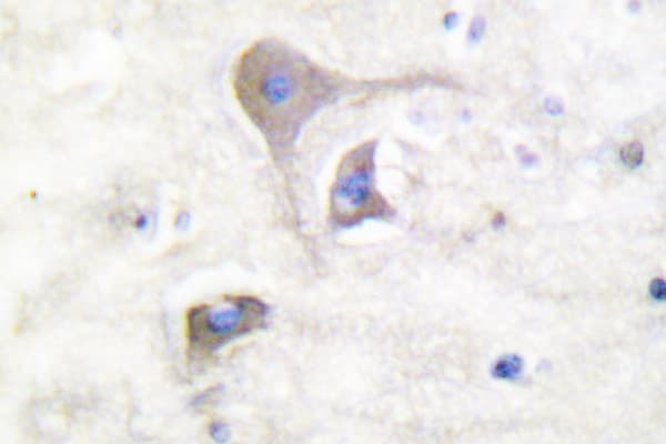 SNCB / Beta-Synuclein Antibody (Ser118)