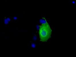 KHK / Ketohexokinase Antibody (clone OTI1D8)