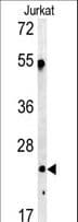 Polyclonal Rabbit anti-Human Complement C1QA Antibody (aa198-227, IHC, WB)