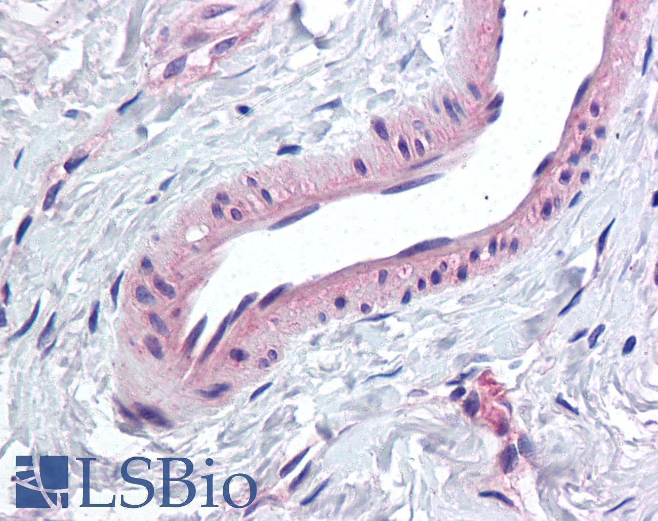 IHC-plus™ Polyclonal Rabbit anti-Human KCNMA1 / BK Antibody (Internal, IHC)