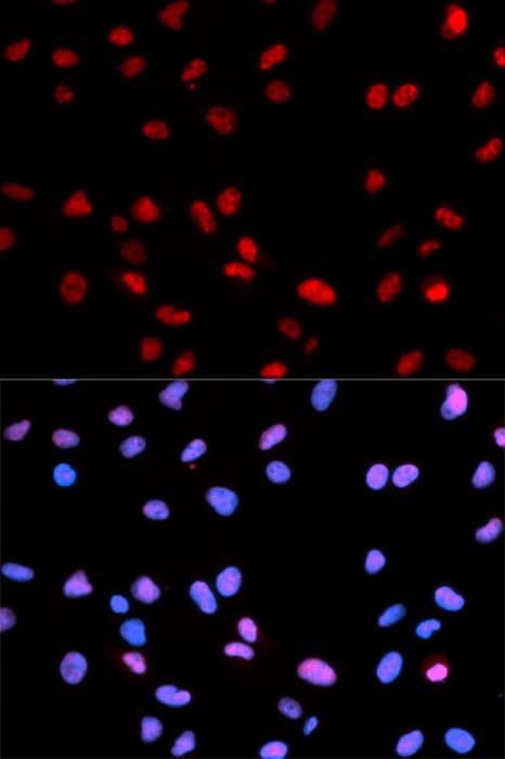 RB1 / Retinoblastoma / RB Antibody (phospho-Ser795)