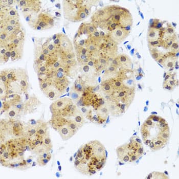 RAD23B / HR23B Antibody