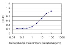IHC-plus™ Monoclonal Mouse anti-Human FOXO3 / FOXO3A Antibody (clone 2C5, IHC, IF, WB)