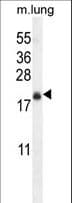 TMEM80 Antibody (aa52-80)