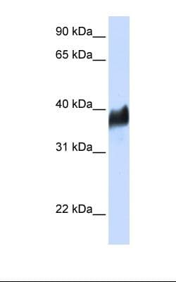 CLN8 Antibody (aa72-121)