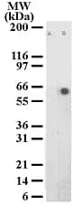 ATF2 Antibody (phospho-Thr71, clone 103C411.2)