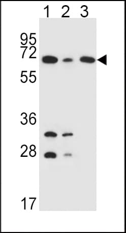 Polyclonal Rabbit anti-Human DLAT / PDC-E2 Antibody (aa579-607, IHC, WB)