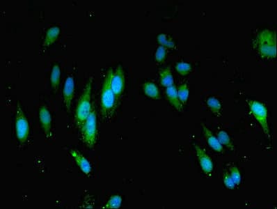 Polyclonal Rabbit anti-Human MOCS2 Antibody (IHC, IF, WB)