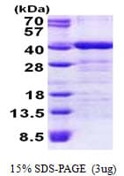 Human TOMM34 Protein (Recombinant His)