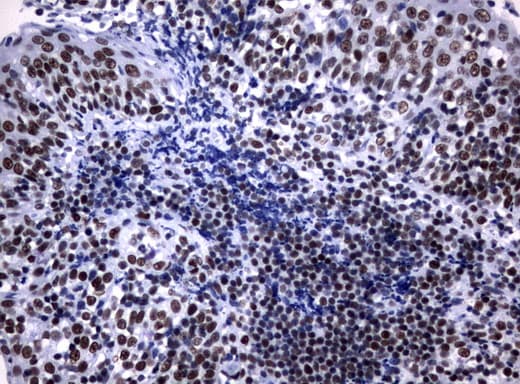 NBN / Nibrin Antibody (aa183-460, clone UMAB100, Carrier-free)
