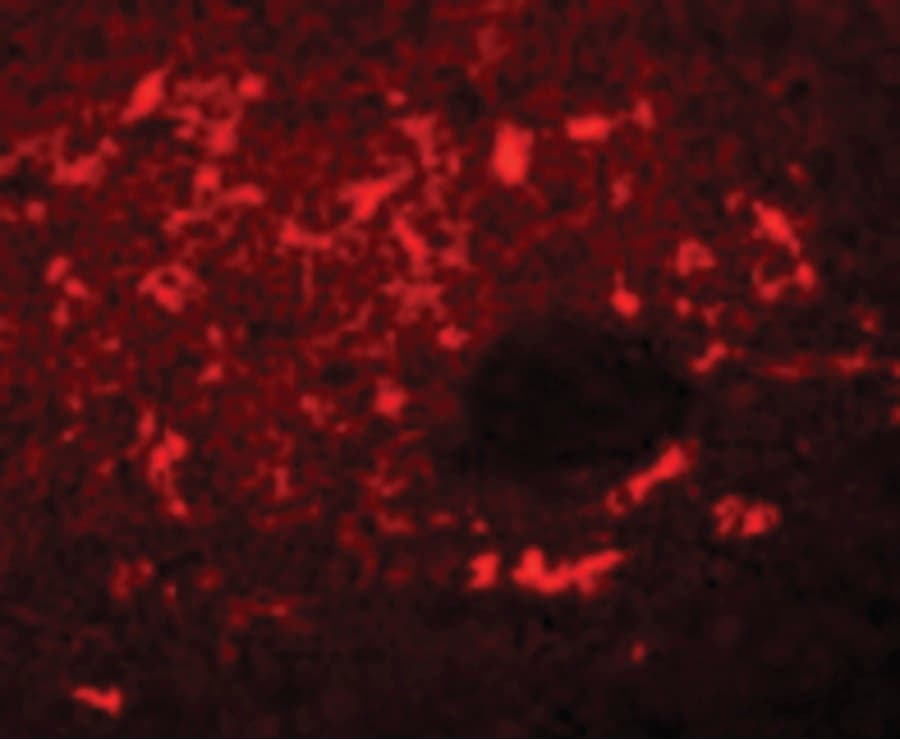 SQSTM1 Antibody