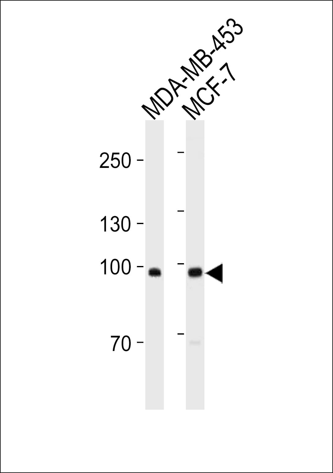 ACE2 / ACE-2 Antibody (aa1-270, clone 881CT16.4.4)