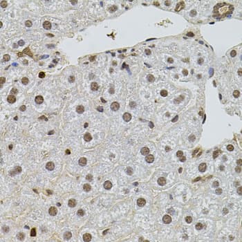 SR140 / U2SURP Antibody