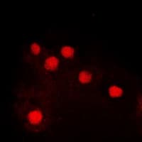 Polyclonal Rabbit anti-Human JUN / c-Jun Antibody (phospho-Ser243, IHC, IF, WB)