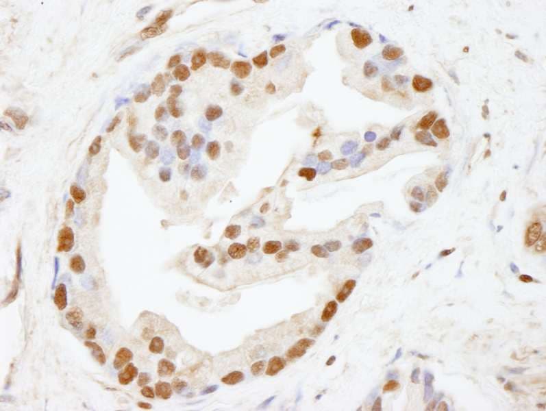 Polyclonal Rabbit anti-Human CHD8 Antibody (aa2252-2302, IHC)