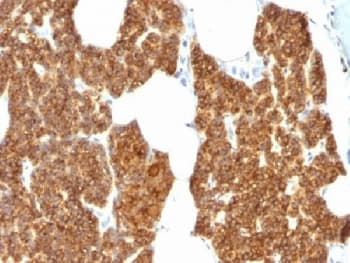 Polyclonal Rabbit anti-Human PTH / Parathyroid Hormone Antibody (IHC, IF)