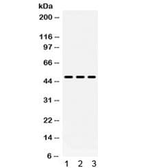 F3 / CD142 / Tissue factor Antibody