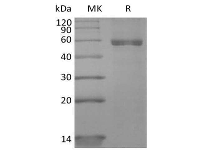 Human Hla-dqa1 gene (dqa1*0201, dqa1*03011 and dqa1*0303) Protein (Recombinant 10His, C-terminus)