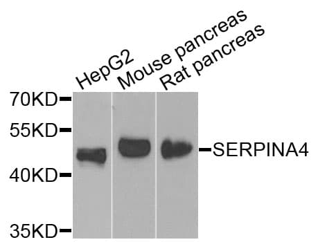 IHC-plus™ Polyclonal Rabbit anti-Human SERPINA4 / Kallistatin Antibody (IHC, IF, WB)
