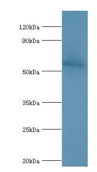 IFNAR2 Antibody (aa27-243)