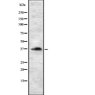 RASSF2 Antibody