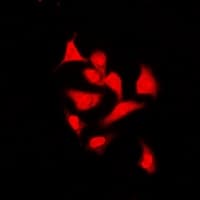 Polyclonal Rabbit anti-Human THRSP Antibody (IF, WB)