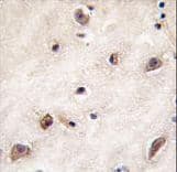 GDF1 Antibody (aa30-59)
