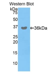 PDHB Antibody (aa31-341, FITC)