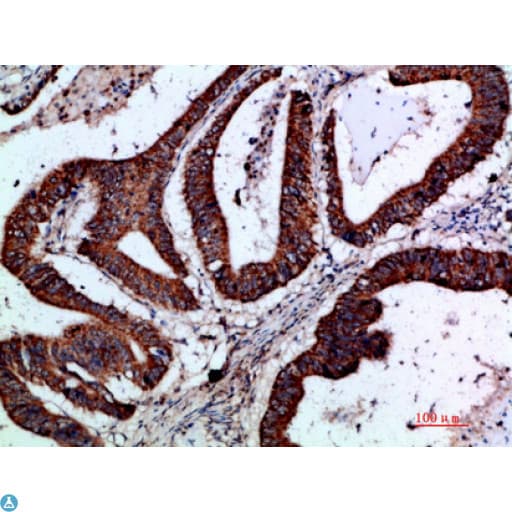 GREM2 / Gremlin 2 Antibody