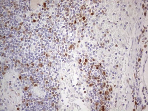 Monoclonal Mouse anti-Human POU2AF1 / BOB1 Antibody (clone OTI2D4, IHC, WB)
