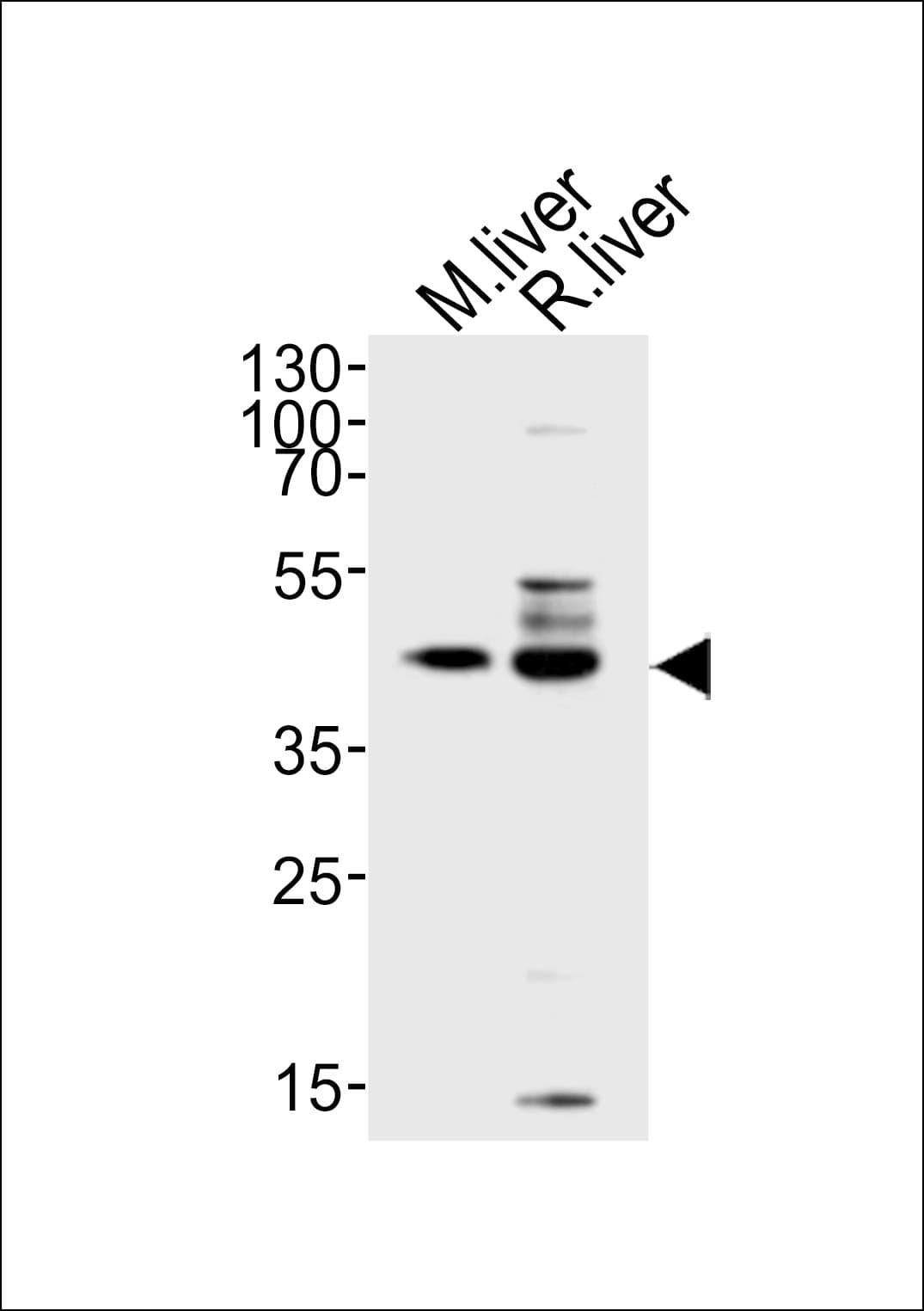 TRAPPC13 / C5orf44 Antibody (aa34-68)