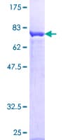 Human PRKAR1A Protein (Recombinant GST)