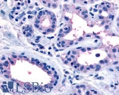 PathPlus™ Polyclonal Rabbit anti-Human OXTR / Oxytocin Receptor Antibody (N-Terminus, IHC)