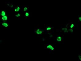IHC-plus™ PHF7 Antibody (clone 1A11)