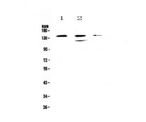 INPP5D / SHIP1 / SHIP Antibody