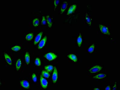 GP9 / CD42a Antibody