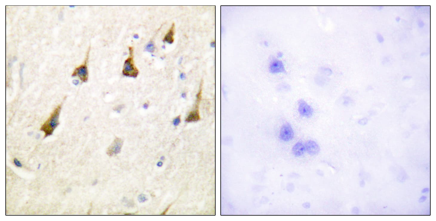 SENP7 Antibody (aa991-1040)