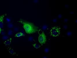 Monoclonal Mouse anti-Human PANK2 Antibody (clone OTI3H9, IHC, IF, WB)