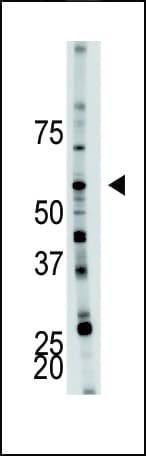 PFKFB4 Antibody (aa266-296)
