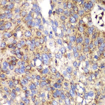 Polyclonal Rabbit anti-Human Osteonectin / SPARC Antibody (IHC, WB)