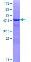 Human CRYBA1 Protein (Recombinant GST)