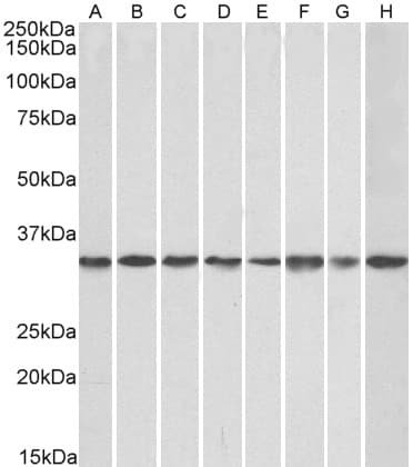 IHC-plus™ GNB2L1 / RACK1 Antibody (aa133-147)